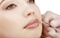 Filler Labbra Milano
