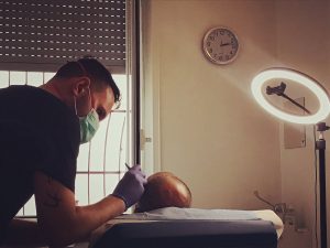 Opinioni tricopigmentazione Milano