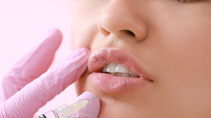 Filler labbra a Milano Nord