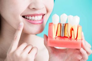 Migliore Implantologia Dentale Milano